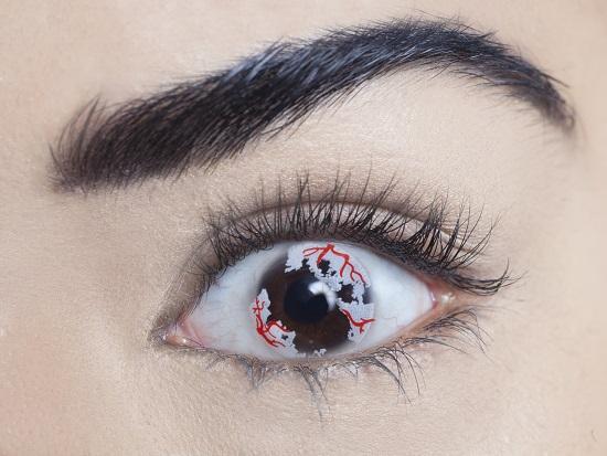 Hemorrhage Contact Lenses